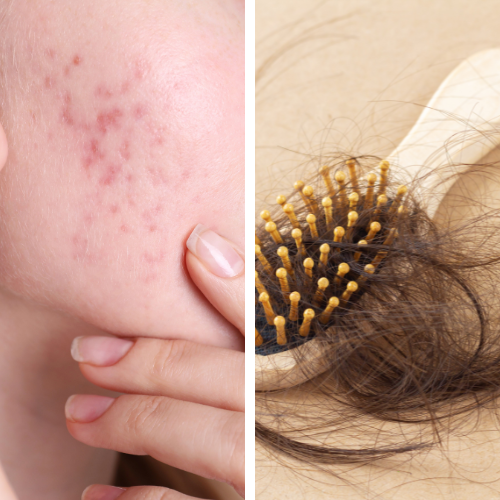 Skin and Hair Problems Diet