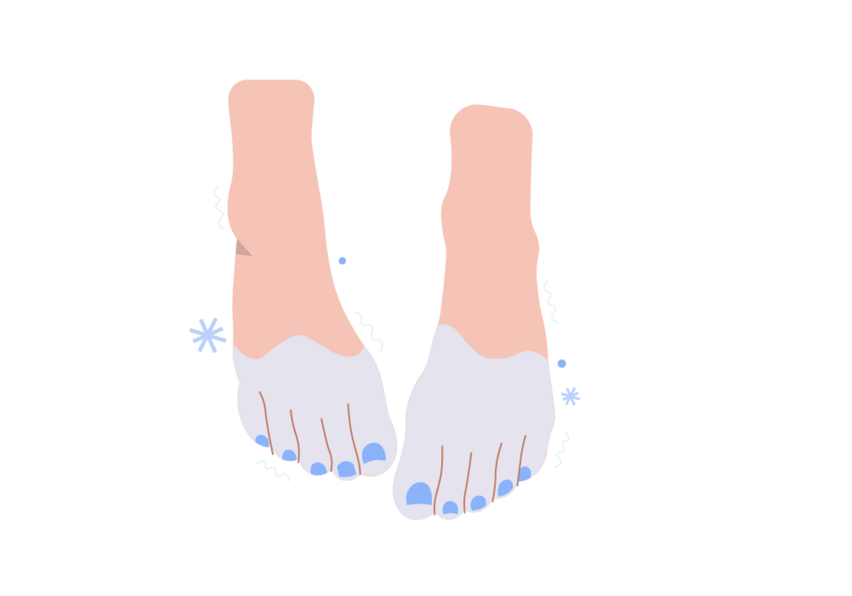 Cold Feet All the Time Poor Circulation or Thyroid Problems