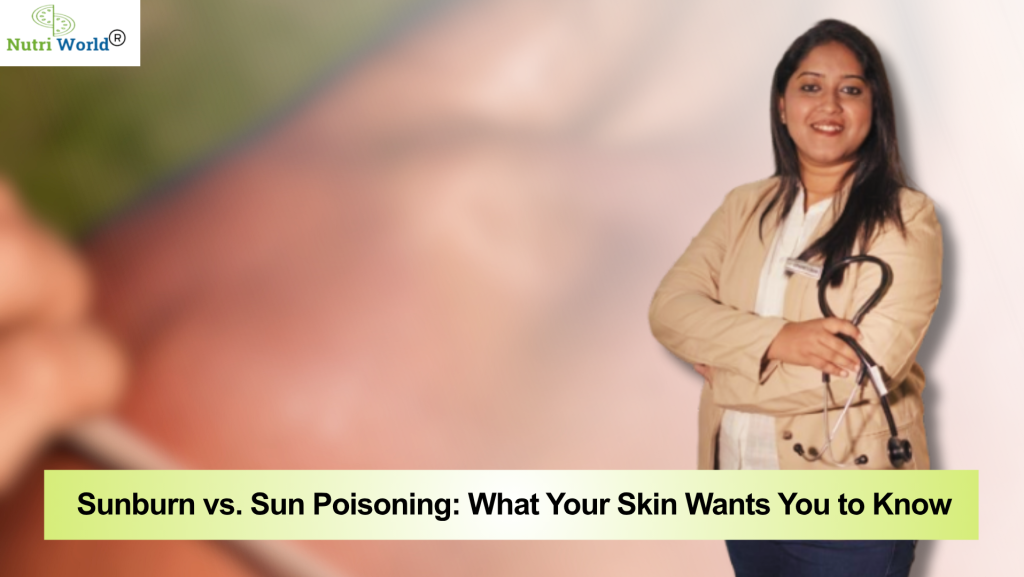 Sunburn vs. Sun Poisoning What Your Skin Wants You to Know